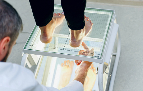 Компьютерная диагностика стоп